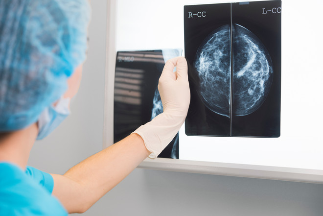 Artikel i Jyllandsposten om effekt af screening for brystkræft